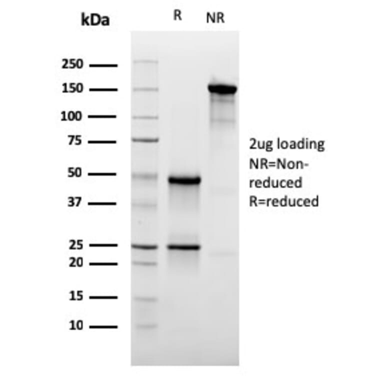 SDS-PAGE - Anti-CD47 Antibody [CD47/3019] (Biotin) (A251234) - Antibodies.com