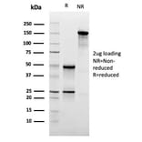 SDS-PAGE - Anti-CD47 Antibody [CD47/3019] (Biotin) (A251234) - Antibodies.com