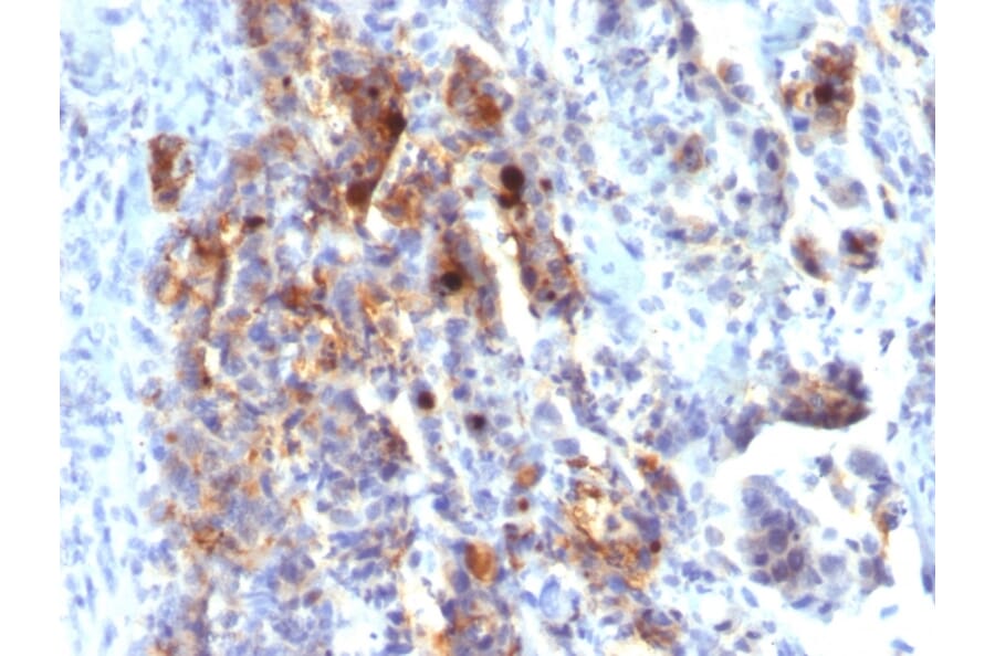 Immunohistochemistry - Anti-Mucin 5AC Antibody [45M1] (Biotin) (A251234) - Antibodies.com