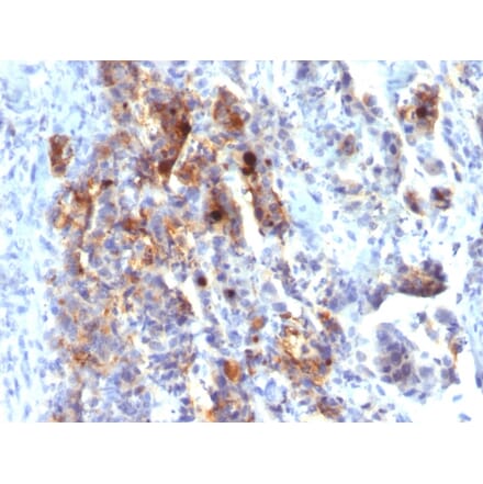 Immunohistochemistry - Anti-Mucin 5AC Antibody [45M1] (Biotin) (A251234) - Antibodies.com