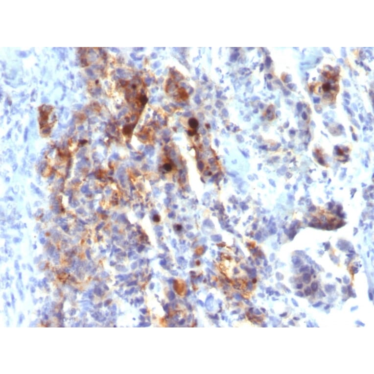 Immunohistochemistry - Anti-Mucin 5AC Antibody [45M1] (Biotin) (A251234) - Antibodies.com