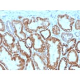 Immunohistochemistry - Anti-Interferon gamma Antibody [IFNG/466] (Biotin) (A251236) - Antibodies.com