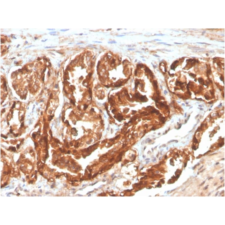 Immunohistochemistry - Anti-CD47 Antibody [CD47/2937] (Biotin) (A251237) - Antibodies.com