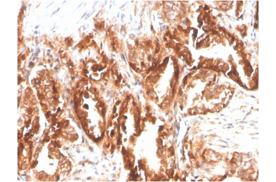 Immunohistochemistry - Anti-CD47 Antibody [CD47/2937] (Biotin) (A251237) - Antibodies.com