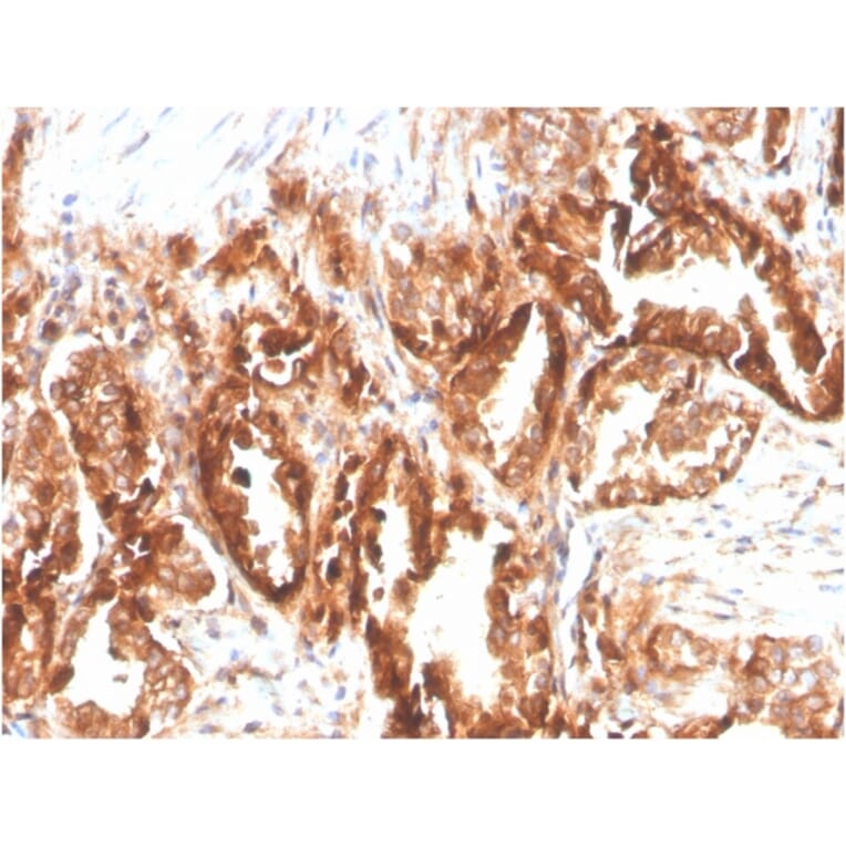 Immunohistochemistry - Anti-CD47 Antibody [CD47/2937] (Biotin) (A251237) - Antibodies.com