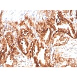 Immunohistochemistry - Anti-CD47 Antibody [CD47/2937] (Biotin) (A251237) - Antibodies.com