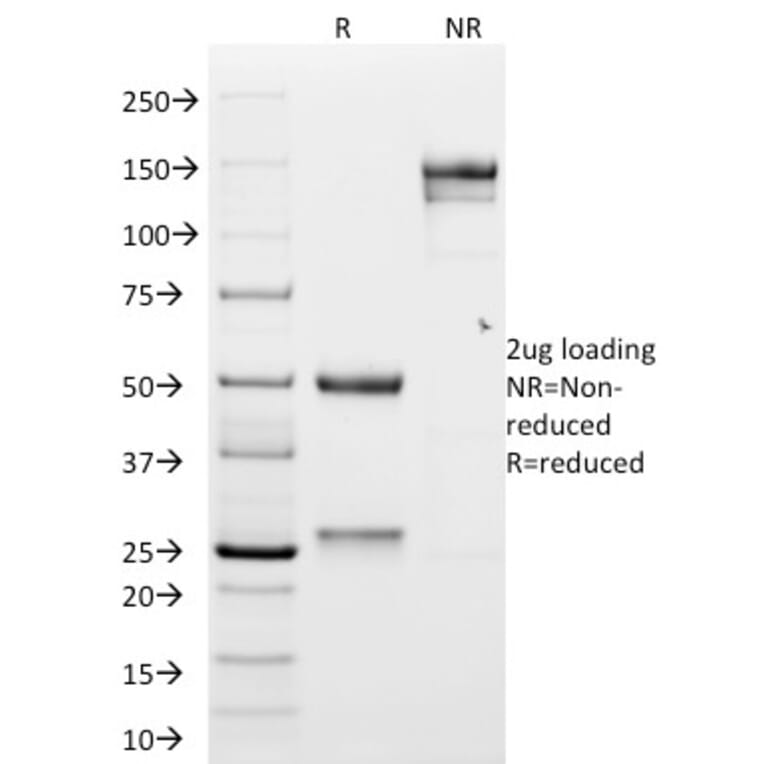 SDS-PAGE - Anti-N Cadherin Antibody [CDH2/1573] - BSA and Azide free (A251240) - Antibodies.com