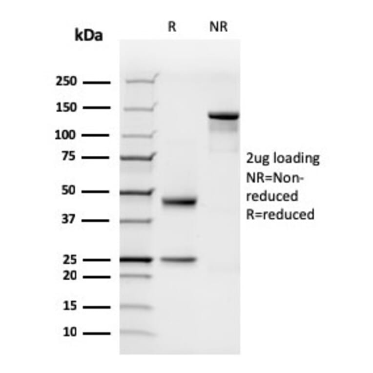 SDS-PAGE - Anti-N Cadherin Antibody [rCDH2/1426] - BSA and Azide free (A251241) - Antibodies.com