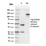 SDS-PAGE - Anti-N Cadherin Antibody [rCDH2/1426] - BSA and Azide free (A251241) - Antibodies.com