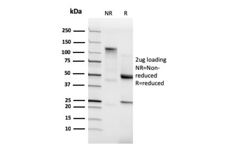 SDS-PAGE - Anti-N Cadherin Antibody [CDH2/3874R] - BSA and Azide free (A251242) - Antibodies.com