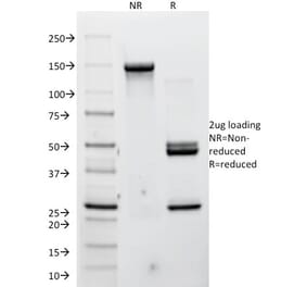 SDS-PAGE - Anti-P Cadherin Antibody [12H6] - BSA and Azide free (A251243) - Antibodies.com