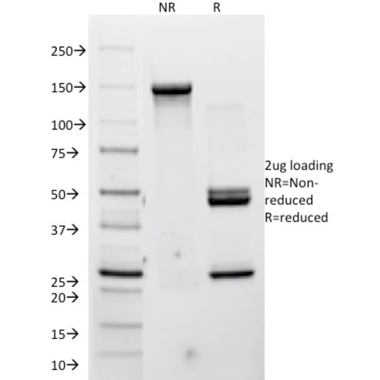 SDS-PAGE - Anti-P Cadherin Antibody [12H6] - BSA and Azide free (A251243) - Antibodies.com