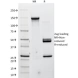 SDS-PAGE - Anti-P Cadherin Antibody [12H6] - BSA and Azide free (A251243) - Antibodies.com
