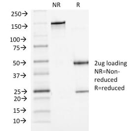 SDS-PAGE - Anti-P Cadherin Antibody [6A9] - BSA and Azide free (A251244) - Antibodies.com