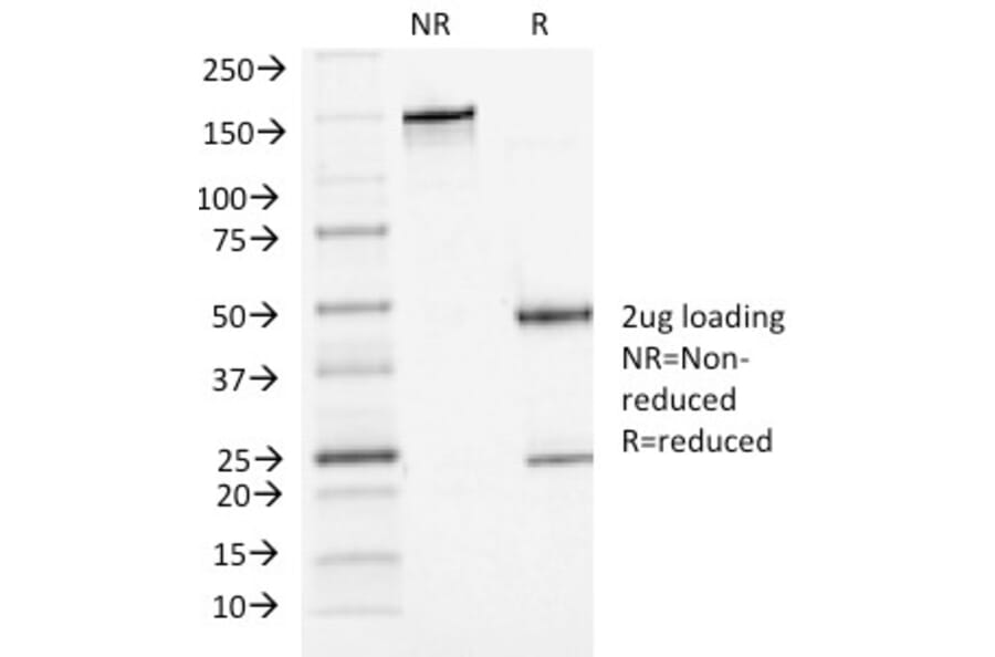 SDS-PAGE - Anti-P Cadherin Antibody [6A9] - BSA and Azide free (A251244) - Antibodies.com