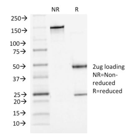 SDS-PAGE - Anti-P Cadherin Antibody [6A9] - BSA and Azide free (A251244) - Antibodies.com