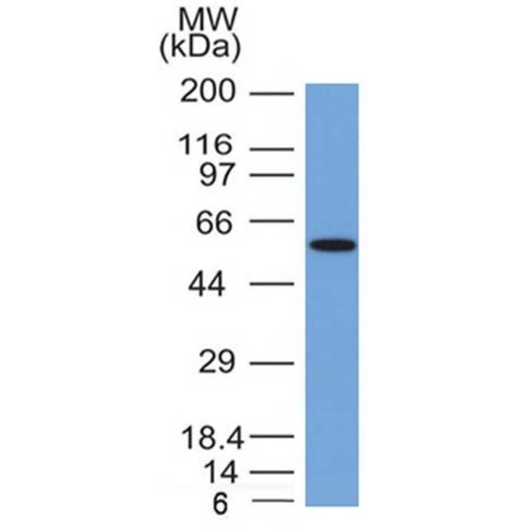 Western Blot - Anti-Occludin Antibody [OCLN/2181] - BSA and Azide free (A251246) - Antibodies.com