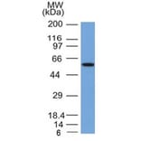 Western Blot - Anti-Occludin Antibody [OCLN/2181] - BSA and Azide free (A251246) - Antibodies.com