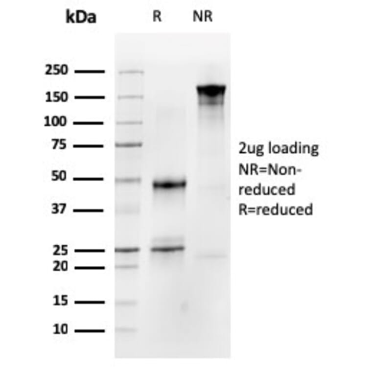 SDS-PAGE - Anti-Occludin Antibody [OCLN/2183] - BSA and Azide free (A251247) - Antibodies.com