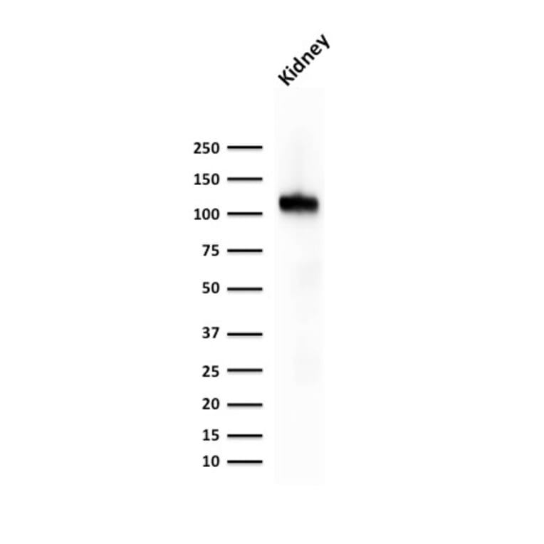 Western Blot - Anti-Cadherin 16 Antibody [CDH16/1071] - BSA and Azide free (A251248) - Antibodies.com