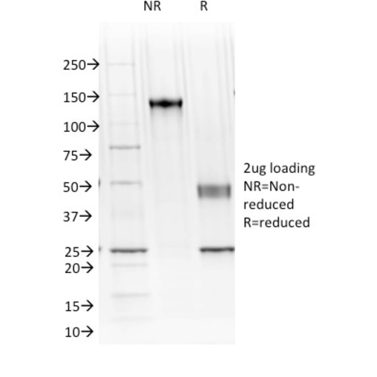 SDS-PAGE - Anti-Cadherin 16 Antibody [CDH16/1071] - BSA and Azide free (A251248) - Antibodies.com