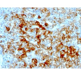 Immunohistochemistry - Anti-Cadherin 16 Antibody [SPM594] - BSA and Azide free (A251248) - Antibodies.com