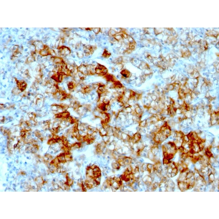 Immunohistochemistry - Anti-Cadherin 16 Antibody [SPM594] - BSA and Azide free (A251248) - Antibodies.com