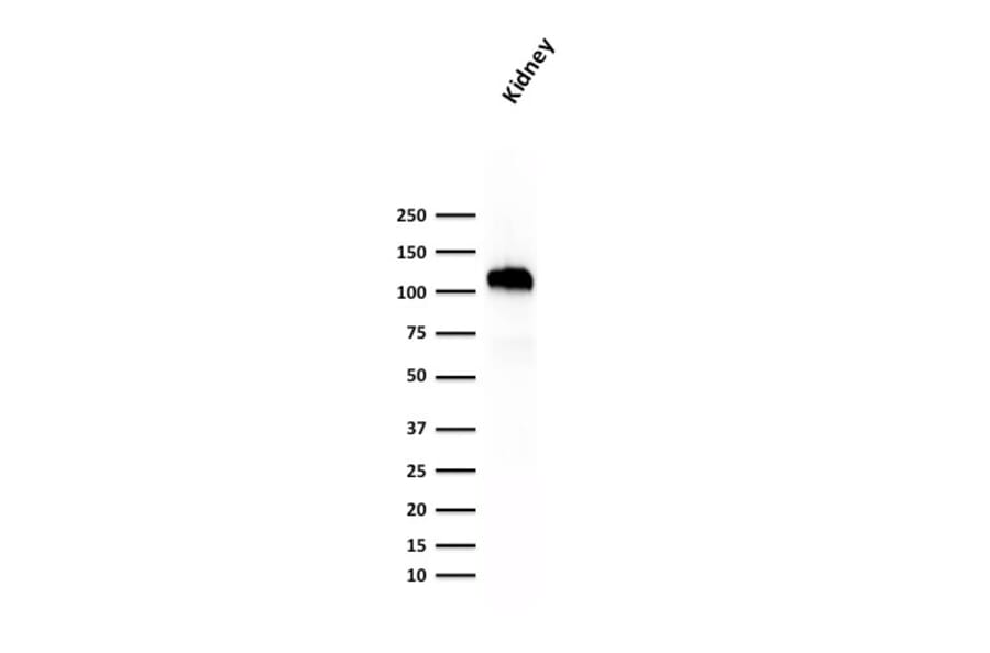 Western Blot - Anti-Cadherin 16 Antibody [SPM594] - BSA and Azide free (A251249) - Antibodies.com
