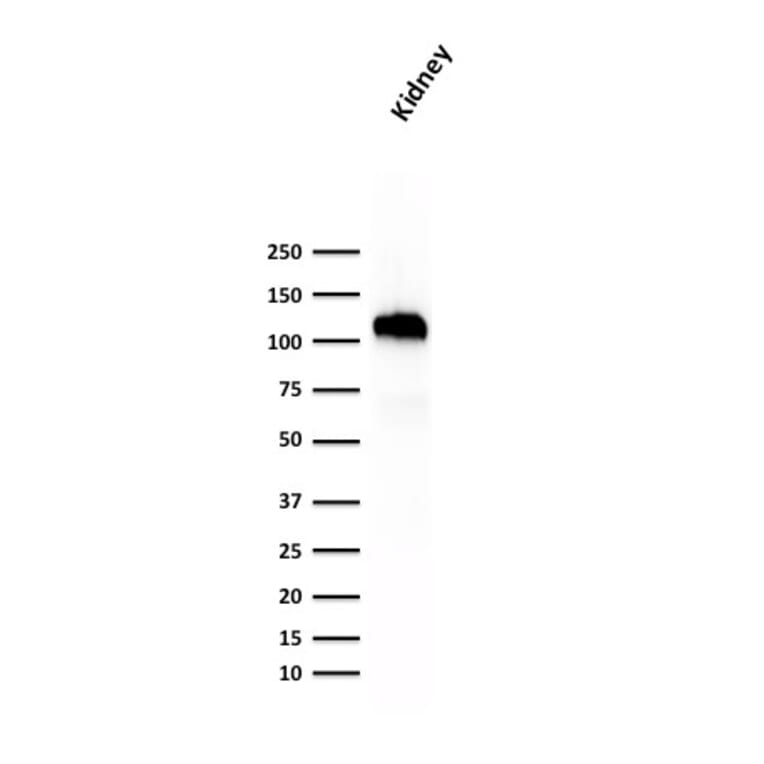 Western Blot - Anti-Cadherin 16 Antibody [SPM594] - BSA and Azide free (A251249) - Antibodies.com