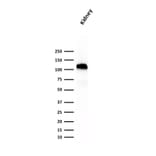 Western Blot - Anti-Cadherin 16 Antibody [SPM594] - BSA and Azide free (A251249) - Antibodies.com