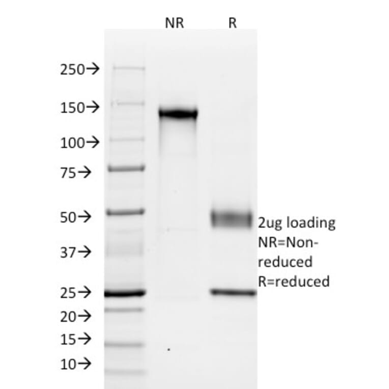 SDS-PAGE - Anti-Cadherin 16 Antibody [SPM594] - BSA and Azide free (A251249) - Antibodies.com