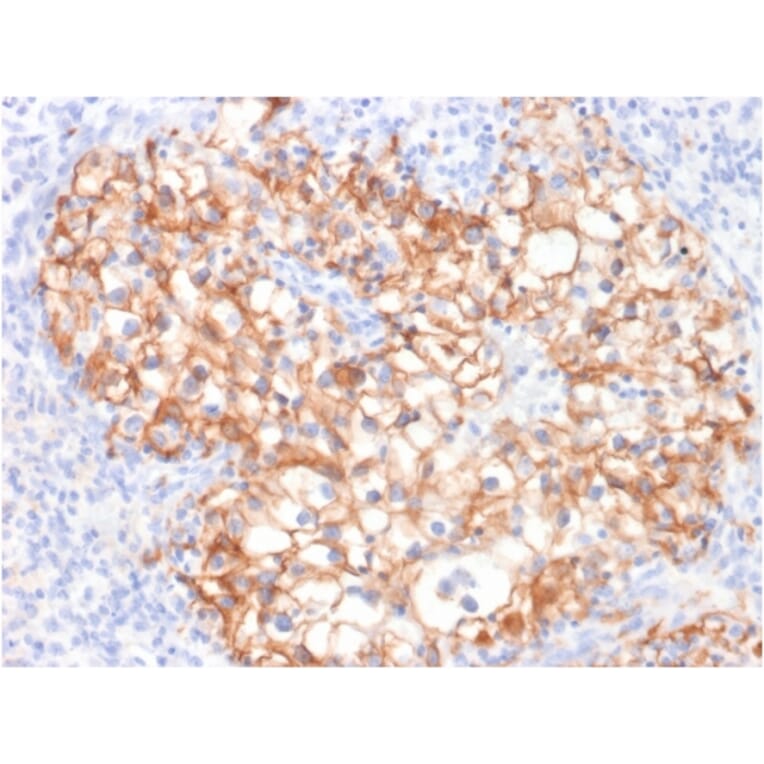 Immunohistochemistry - Anti-Cadherin 16 Antibody [CDH16/2125] - BSA and Azide free (A251251) - Antibodies.com
