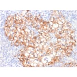 Immunohistochemistry - Anti-Cadherin 16 Antibody [CDH16/2125] - BSA and Azide free (A251251) - Antibodies.com