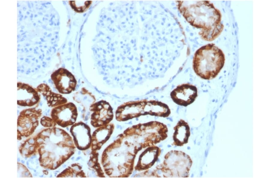 Immunohistochemistry - Anti-Cadherin 16 Antibody [CDH16/2125] - BSA and Azide free (A251251) - Antibodies.com