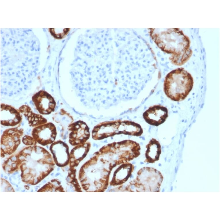 Immunohistochemistry - Anti-Cadherin 16 Antibody [CDH16/2125] - BSA and Azide free (A251251) - Antibodies.com