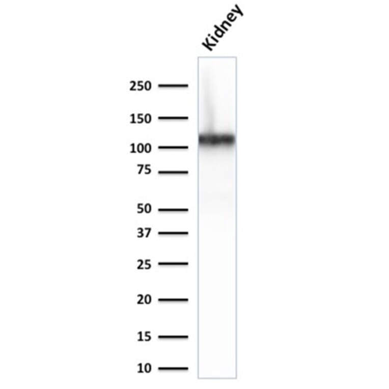 Western Blot - Anti-Cadherin 16 Antibody [CDH16/2125] - BSA and Azide free (A251251) - Antibodies.com
