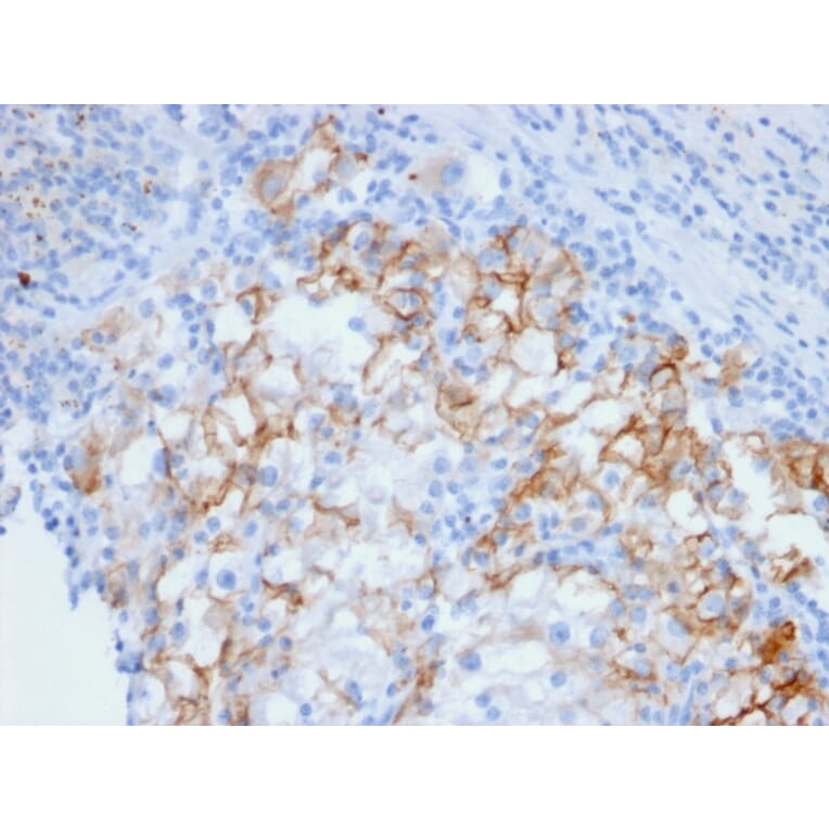 Immunohistochemistry - Anti-Cadherin 16 Antibody [CDH16/2448] - BSA and Azide free (A251252) - Antibodies.com