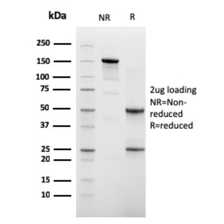 SDS-PAGE - Anti-Cadherin 16 Antibody [CDH16/2448] - BSA and Azide free (A251252) - Antibodies.com