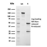 SDS-PAGE - Anti-Cadherin 16 Antibody [CDH16/2448] - BSA and Azide free (A251252) - Antibodies.com