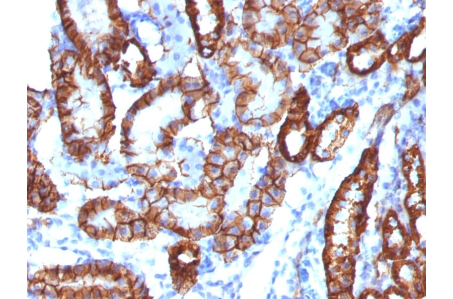 Immunohistochemistry - Anti-Cadherin 16 Antibody [CDH16/1532R] - BSA and Azide free (A251253) - Antibodies.com