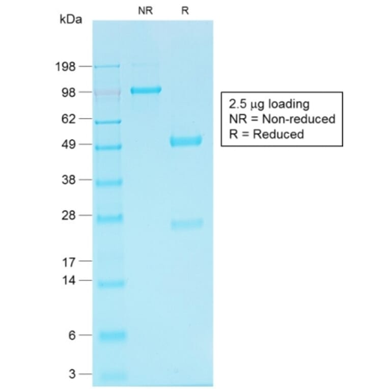 SDS-PAGE - Anti-Cadherin 16 Antibody [CDH16/1532R] - BSA and Azide free (A251253) - Antibodies.com