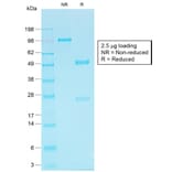 SDS-PAGE - Anti-Cadherin 16 Antibody [CDH16/1532R] - BSA and Azide free (A251253) - Antibodies.com