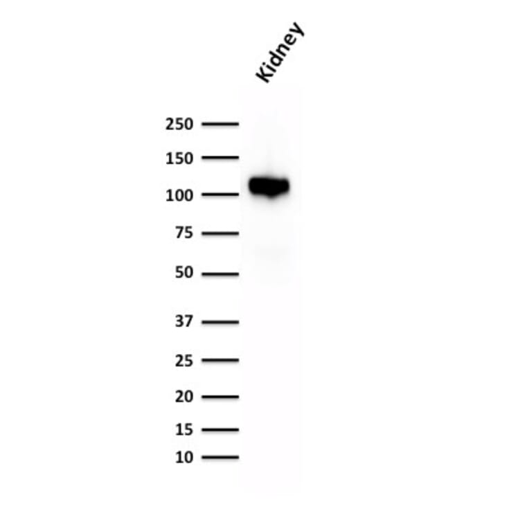 Western Blot - Anti-Cadherin 16 Antibody [CDH16/1532R] - BSA and Azide free (A251253) - Antibodies.com