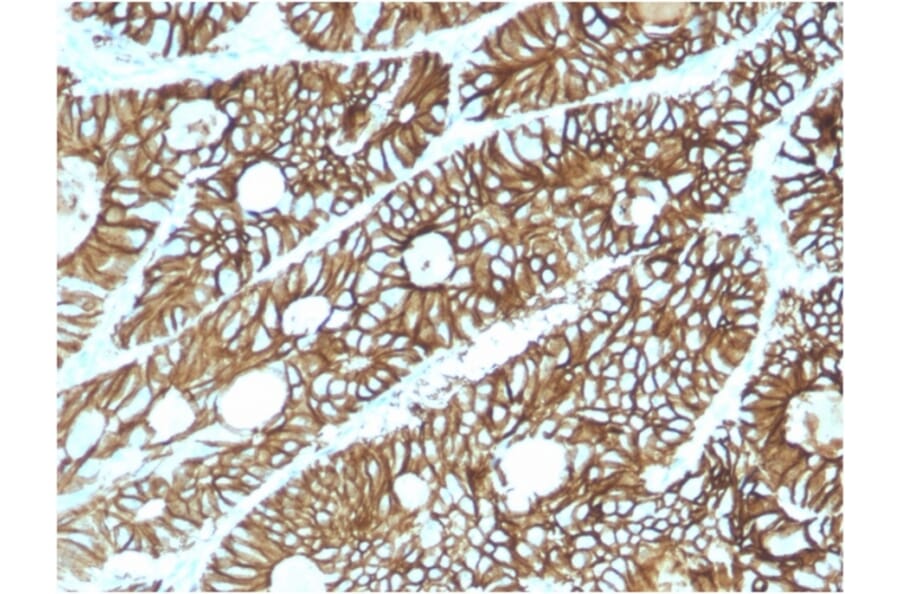 Immunohistochemistry - Anti-LI Cadherin Antibody [CDH17/2615] - BSA and Azide free (A251255) - Antibodies.com