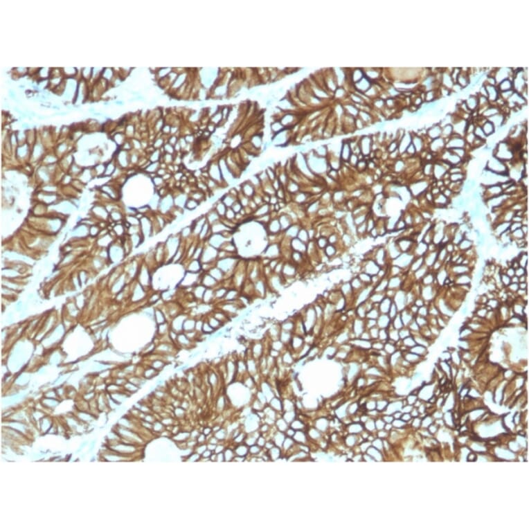 Immunohistochemistry - Anti-LI Cadherin Antibody [CDH17/2615] - BSA and Azide free (A251255) - Antibodies.com