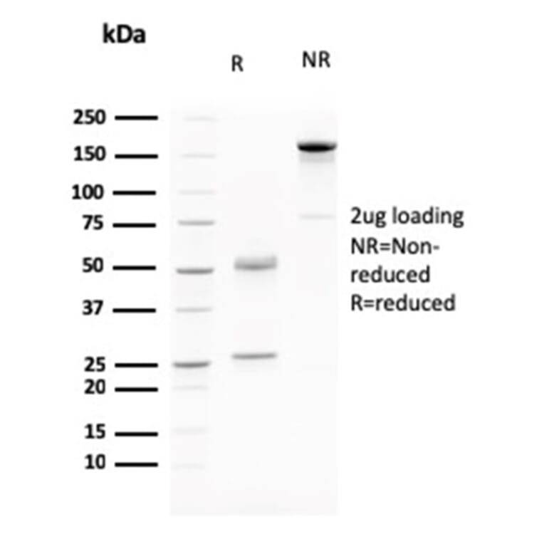 SDS-PAGE - Anti-LI Cadherin Antibody [CDH17/2615] - BSA and Azide free (A251255) - Antibodies.com