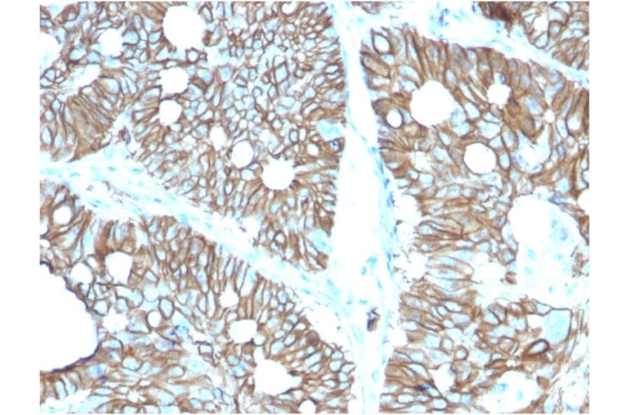 Immunohistochemistry - Anti-LI Cadherin Antibody [CDH17/2616] - BSA and Azide free (A251256) - Antibodies.com