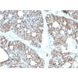Immunohistochemistry - Anti-LI Cadherin Antibody [CDH17/2616] - BSA and Azide free (A251256) - Antibodies.com