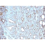 Immunohistochemistry - Anti-LI Cadherin Antibody [CDH17/2617] - BSA and Azide free (A251257) - Antibodies.com
