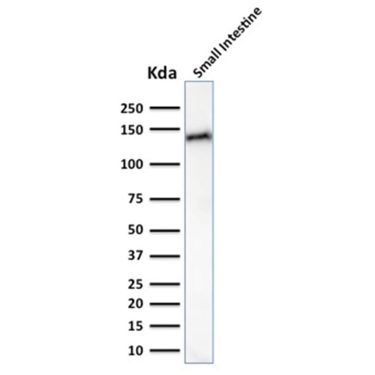 Western Blot - Anti-LI Cadherin Antibody [CDH17/2617] - BSA and Azide free (A251257) - Antibodies.com